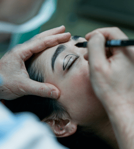 Cirurgia Palpebral